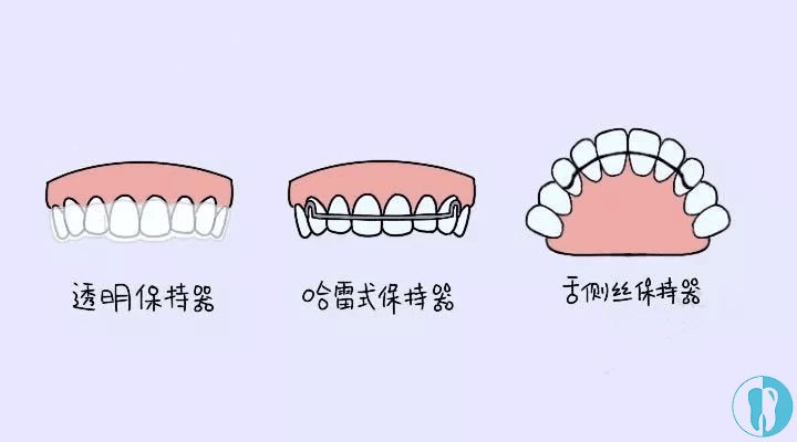 ▼不知道牙套保持器长什么样子的亲?往这儿瞧!