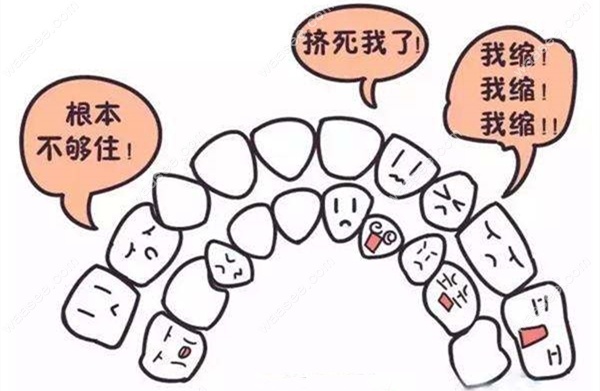 正畸科普:牙齿拥挤度达到多少毫米才要拔牙矫正呢?